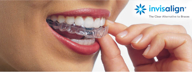 invisalign